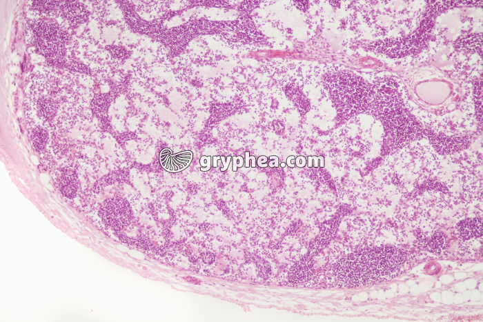 Ganglion lymphatique x25 - gryphea.com